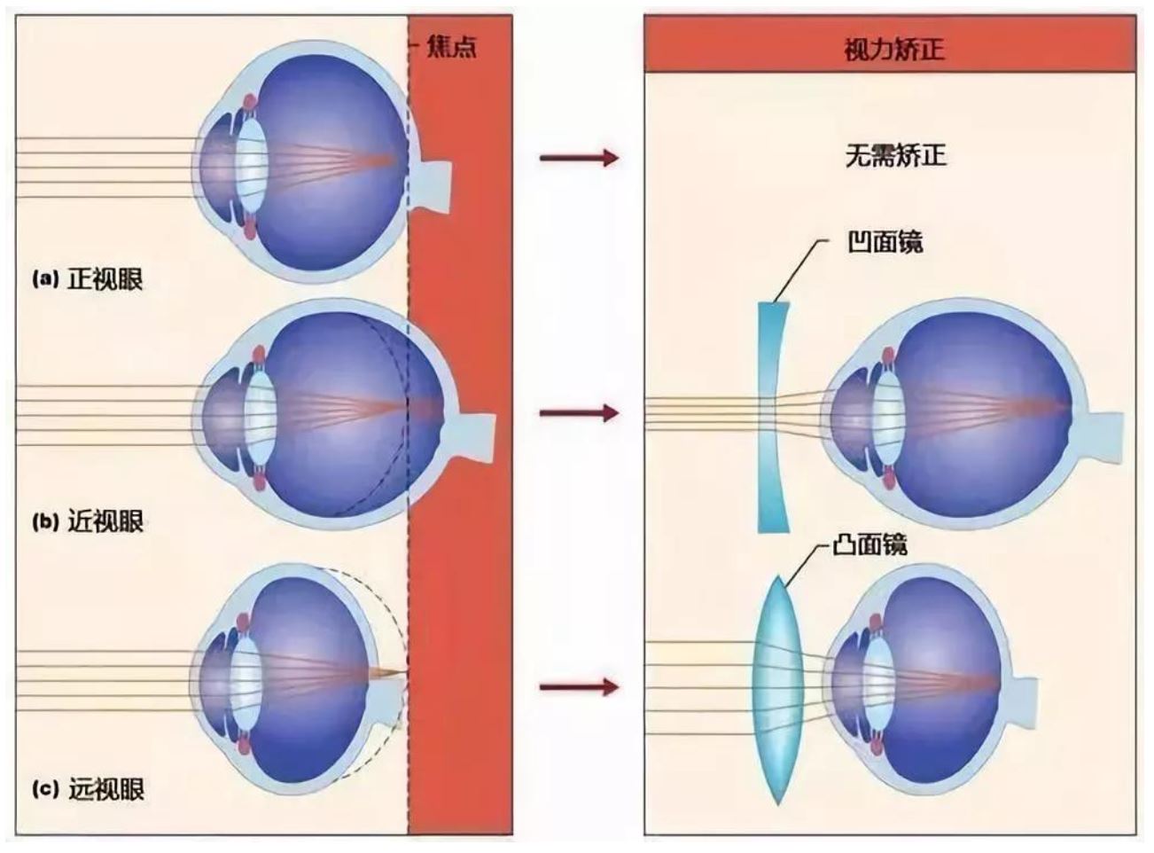 网上配镜