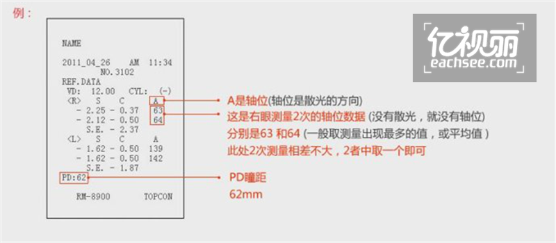 配镜咨询眼镜网 配镜咨询正品眼镜网