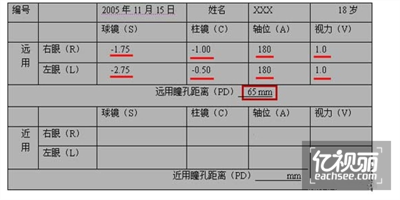 配镜咨询眼镜网 配镜咨询正品眼镜网