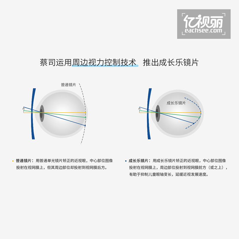 依视路和蔡司哪个好