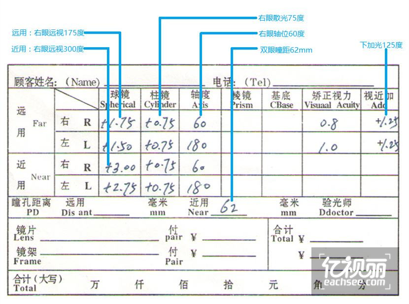 配镜咨询眼镜网 配镜咨询正品眼镜网